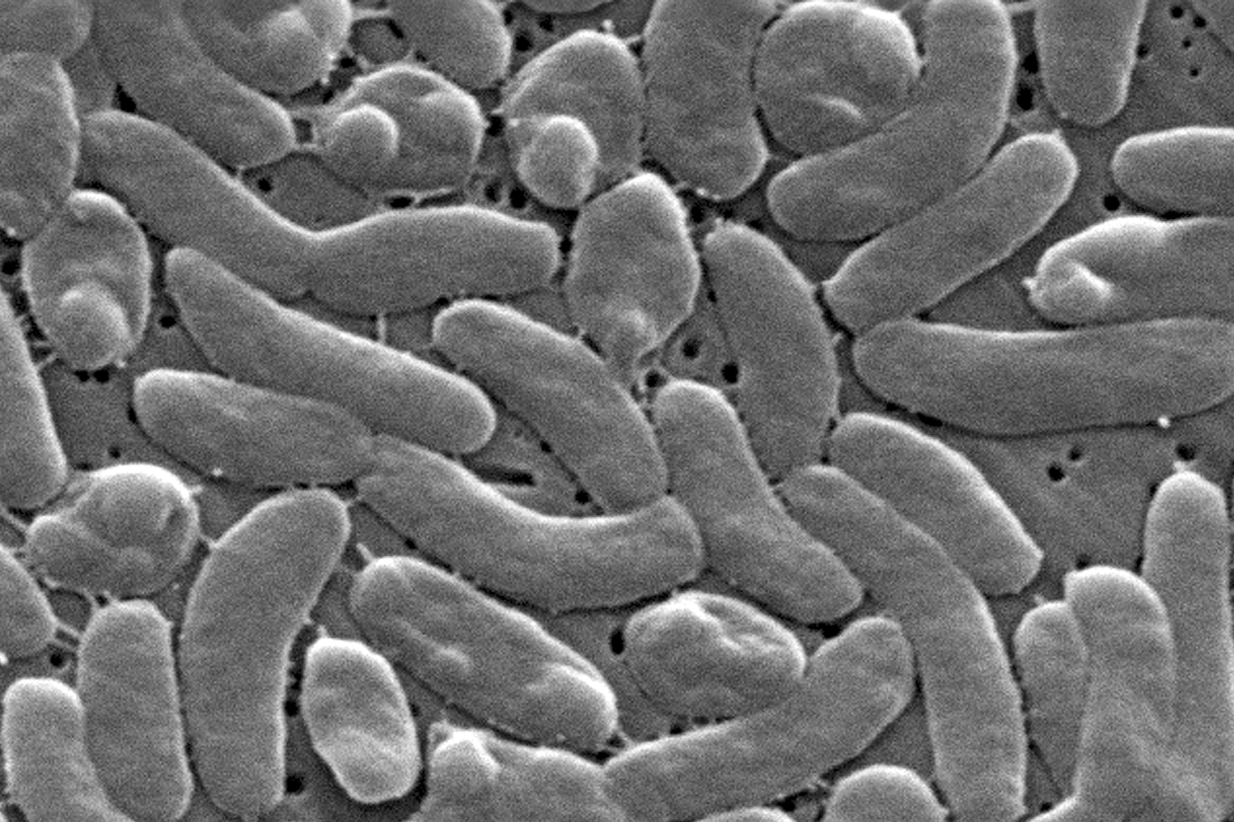 This electron microscope image provided by the Centers for Disease Control and Prevention shows Vibrio vulnificus bacteria.