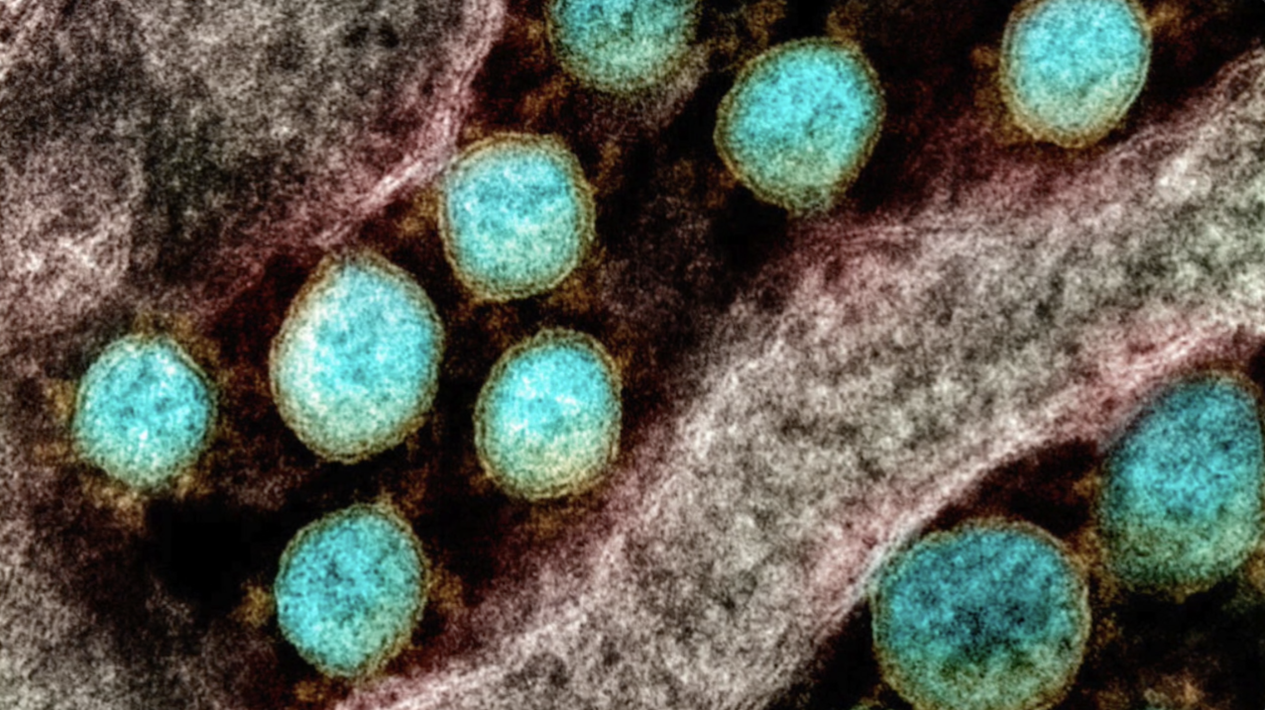 Cross-reactive T cells will not speed up herd immunity