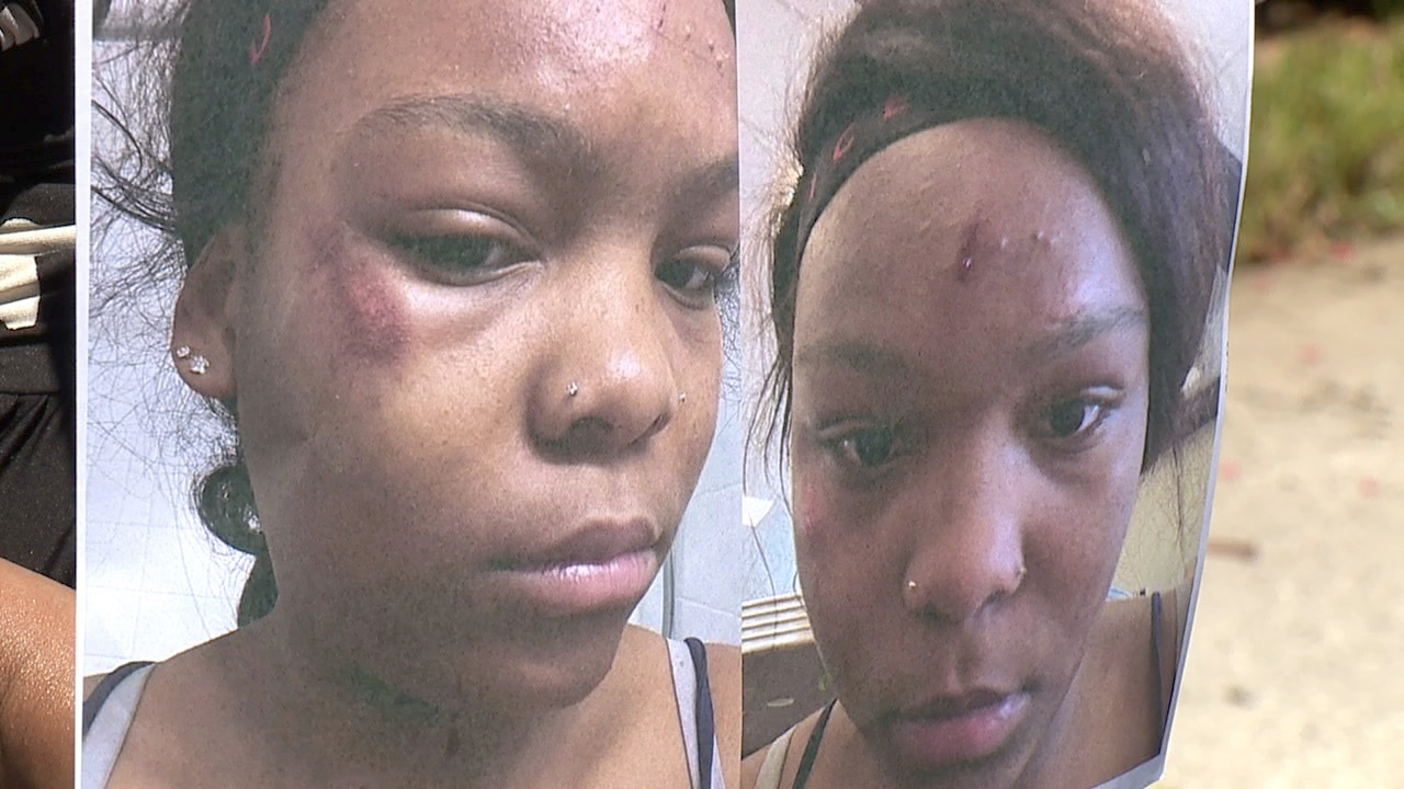 teen injured during arrest.png