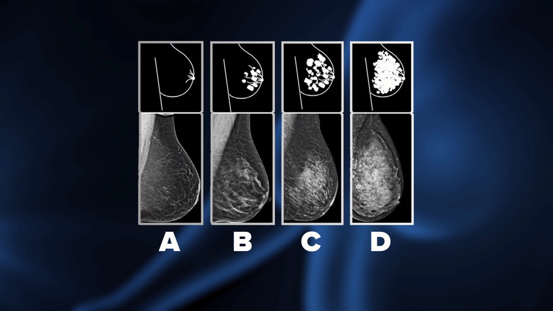 Breast density characterization scale