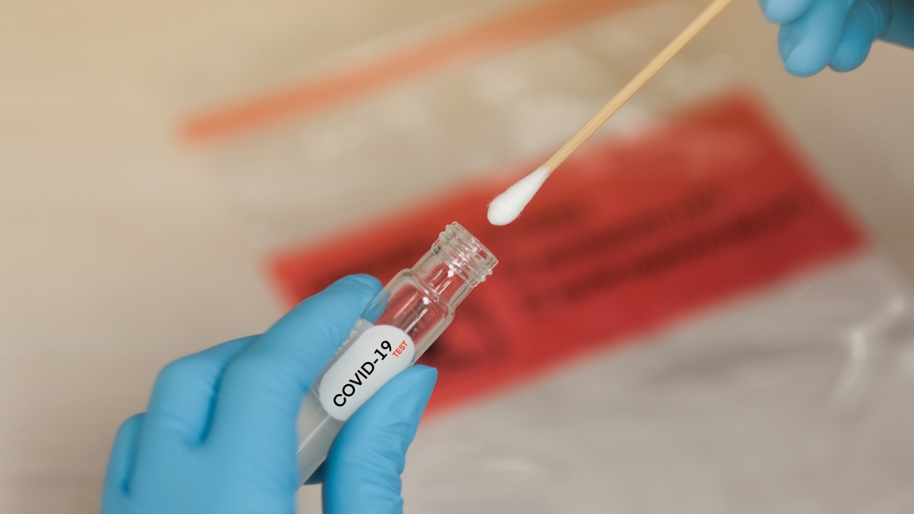 COVID-19 Nasal swab laboratory test in hospital lab
