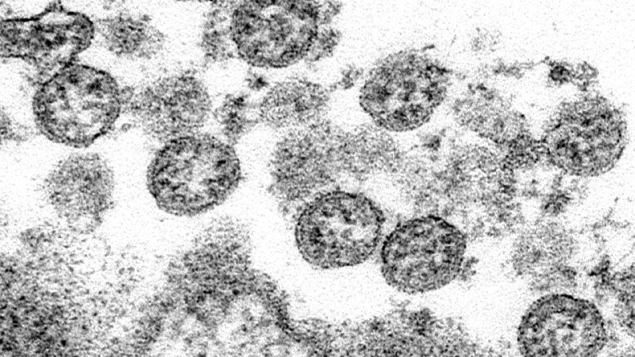 Serious coronavirus-linked condition hit 285 US children