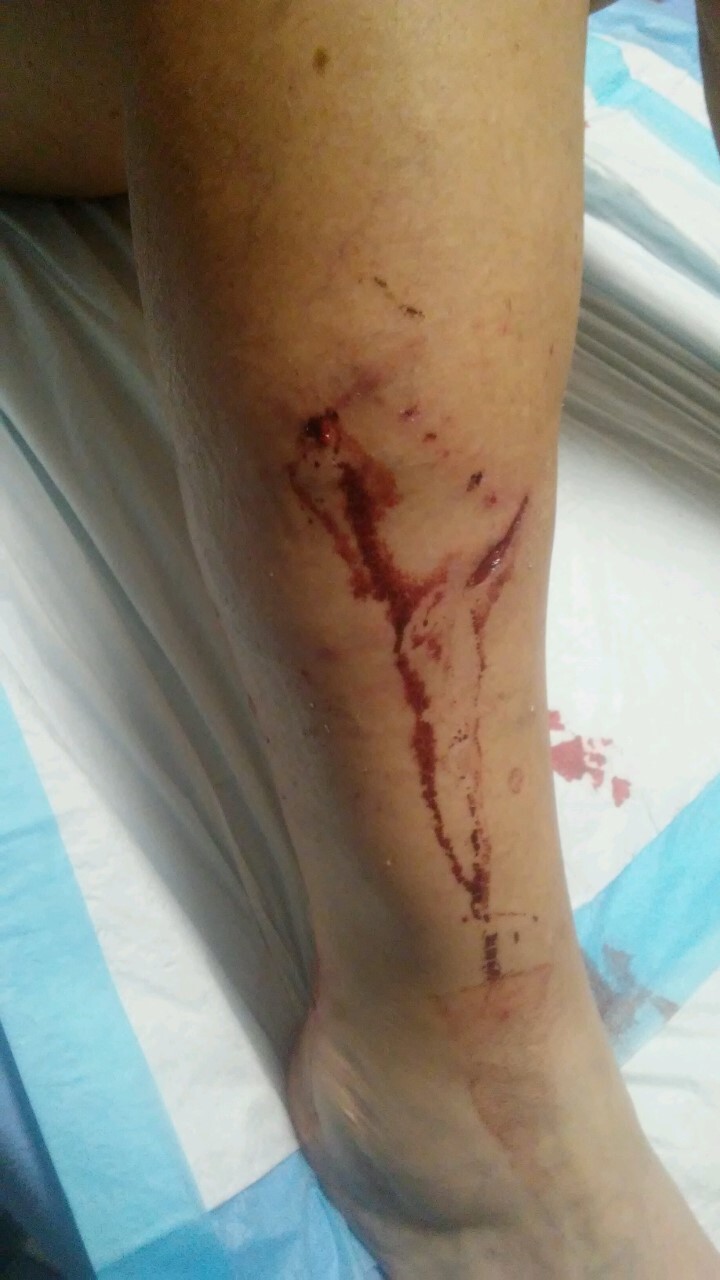 Brighton dog attack