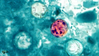 Cyclospora