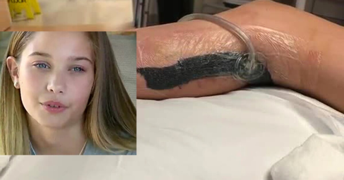 Girl, 12, contracts flesh-eating bacteria during FL vacation