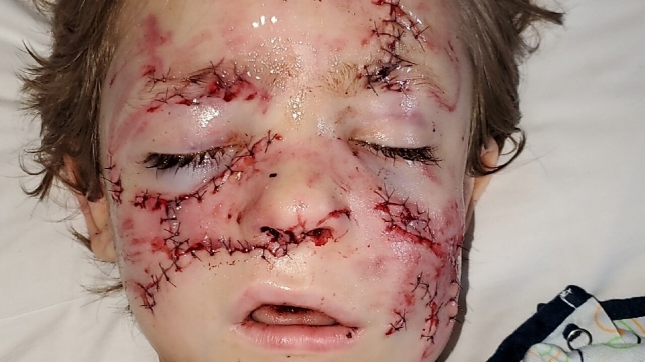 6 Year Old Boy Attacked By Dog Has Horrific Injuries 06.01.2021 · a puppy suffered horrific injuries after he was deliberately covered in boiling tar (pictures: 6 year old boy attacked by dog has