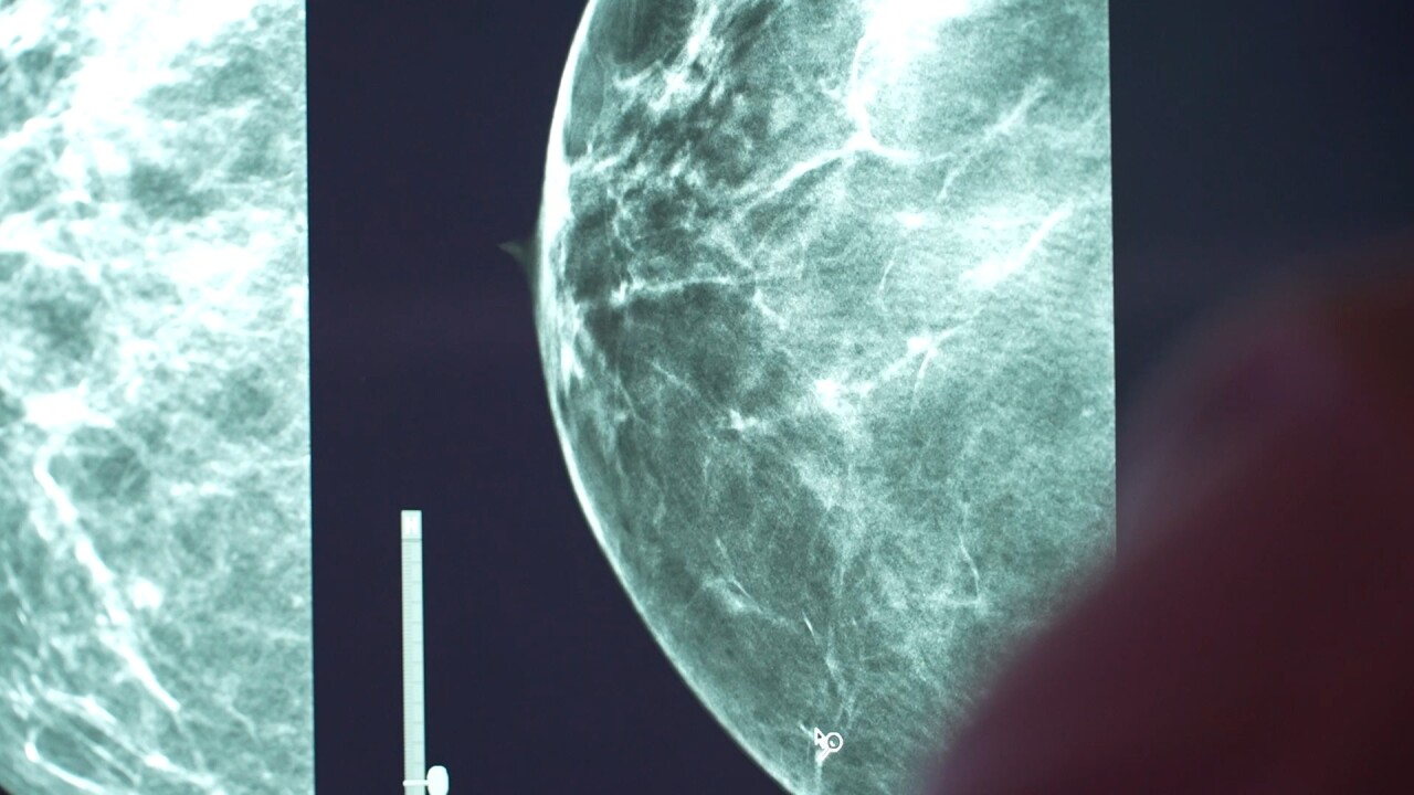 breast 6_2.21.1.jpg