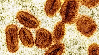 Scientists Charged Mpox