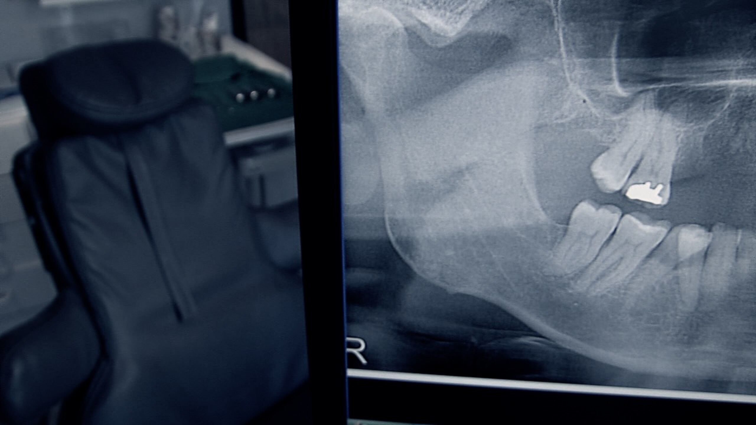 Lawsuits filed against Arizona nurse anesthetist after two dental