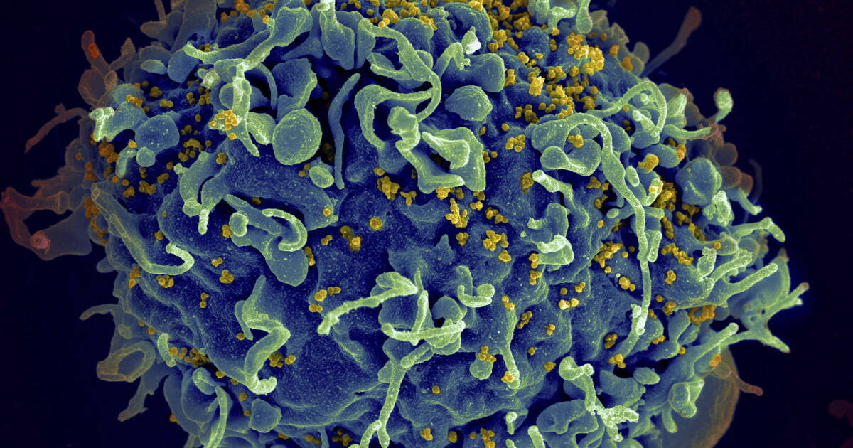 New HIV cases in Hamilton County are down 50% since 2018 - Vimarsana News