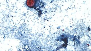 cyclospora.jpg