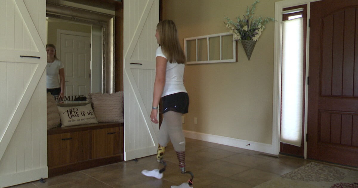 Thirteen years after double amputation, Laurel teen says nothing slows her down - Vimarsana News