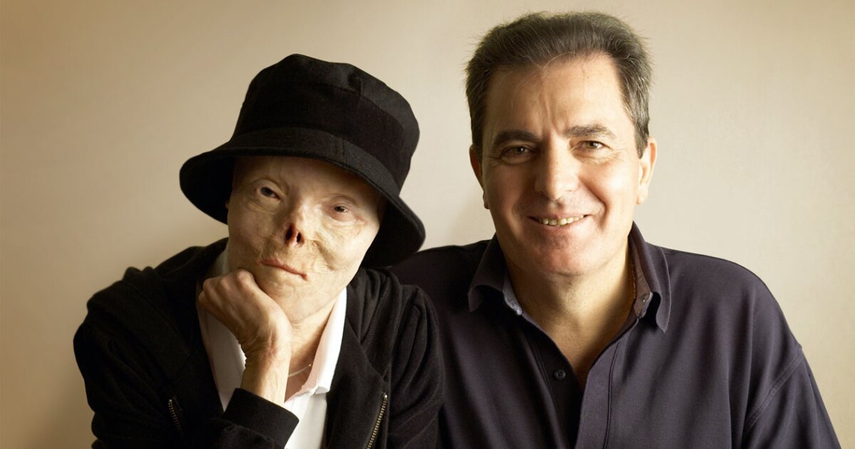 'Face of Drunk Driving' Jacqui Saburido dies after battle with cancer