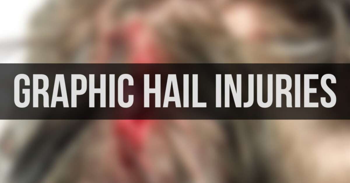 GRAPHIC CONTENT WARNING: Injuries caused by early August hailstorm