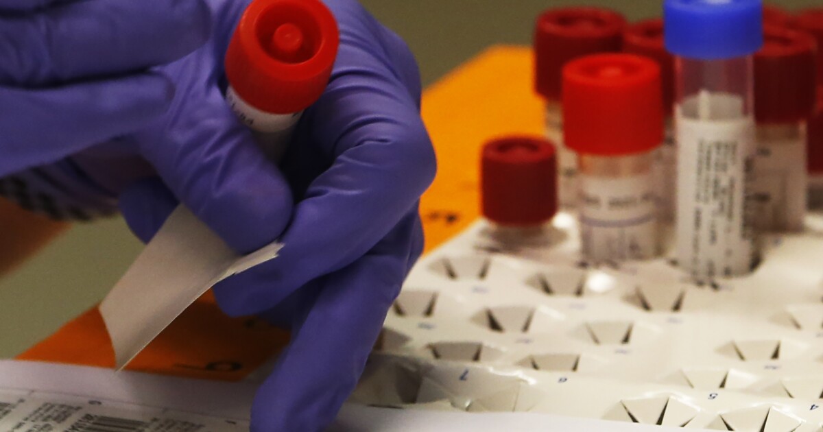 Sonora Quest Labs Announces More COVID 19 Antibody Testing sonora-quest-labs-announces-more-covid-19-antibody-testing