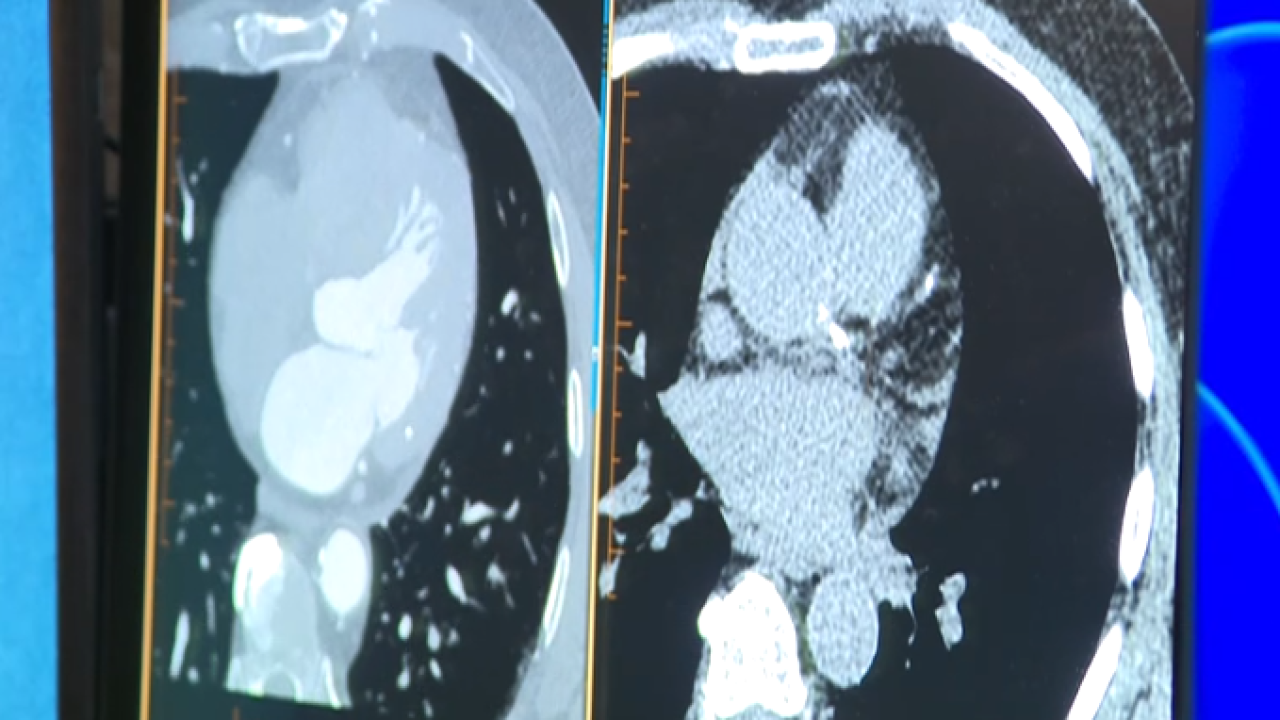 CT scan.png