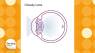 Cataract Surgery Customized for You