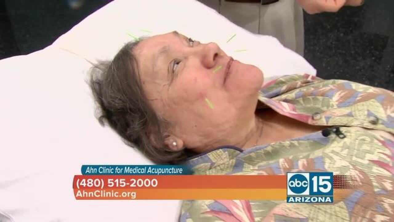 Bless you! Medical acupuncture for allergies