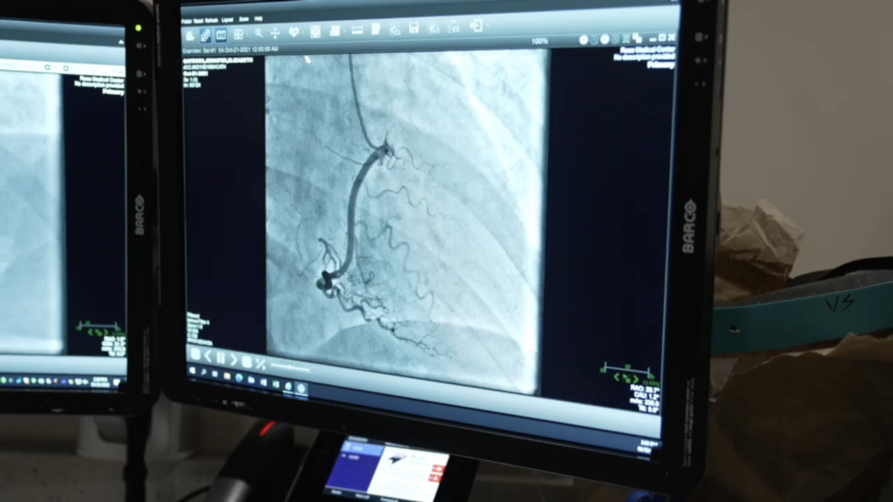 How to protect your heart as respiratory illnesses like flu, COVID spread