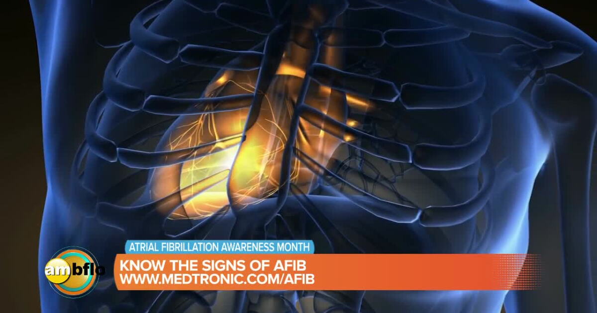 Afib Hand Sign Know the signs of AFIB