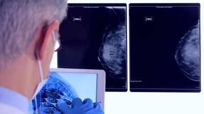 Cincinnati-based company using AI to diagnose coronary artery disease risk during a mammogram
