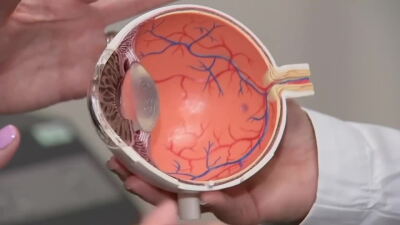 The delicate eyeball is a hot spot for traumatic injuries
