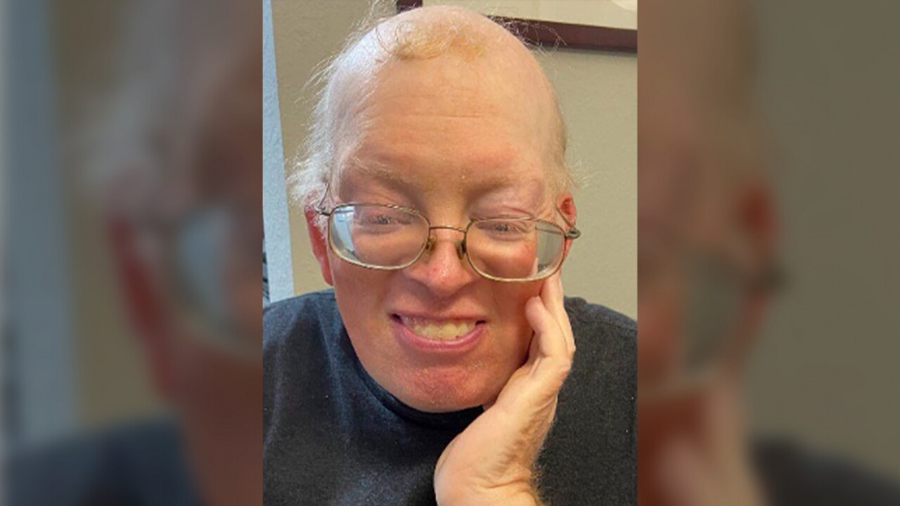 Dennis Brown is shown.