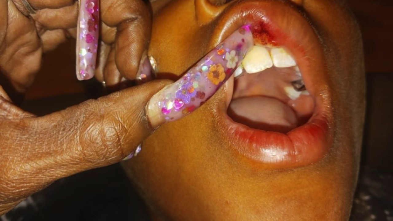 Boy bullied at Newport News elementary school