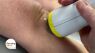 A Solution for Knee Pain: No Surgery & No Injections