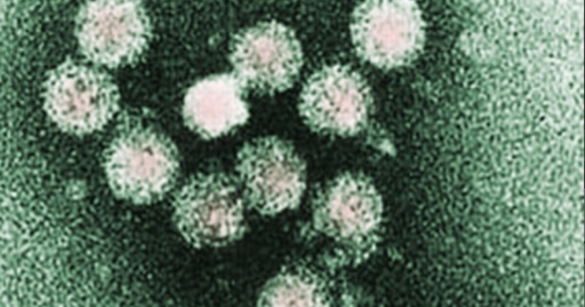 Workers From Multiple Pasco County Restaurants Tested Positive For Hepatitis A Earlier This Year