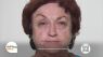 Plexaderm Helps Reduce Signs of Aging