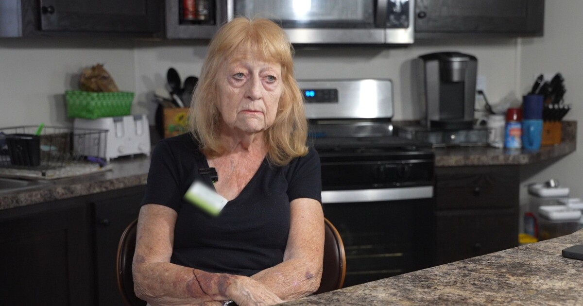 Billings woman speaks out after dog killed in violent dog attack