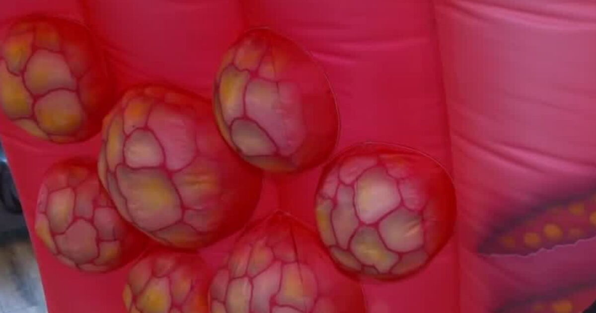 Colon Guard Inflatable Intermountain 'Inflatable Colon' educates Utahns on colorectal cancer
