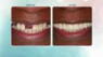 Same Day Smiles