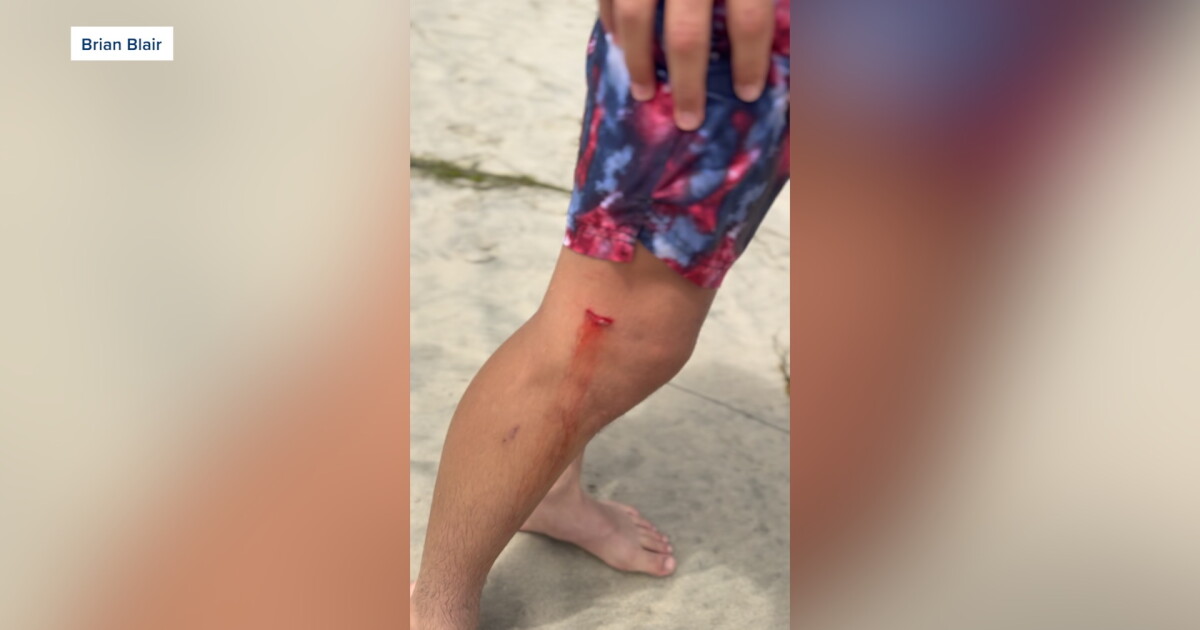 Experts warn of toxic algae after teenage boy was bitten by sea lion in Del Mar - Vimarsana News