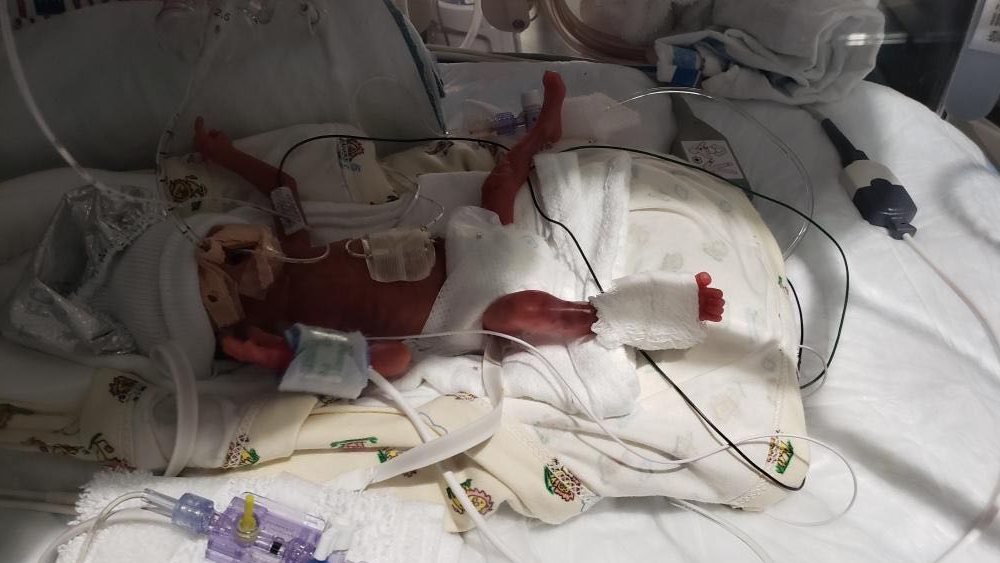 Kresten-Mason_Polk-Co.-littlest-miracle-2.png