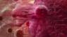 Researchers develop breakthrough compound that kills breast cancer in animals