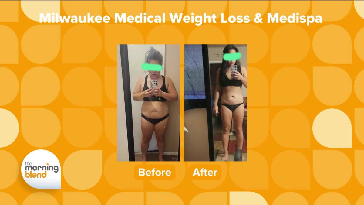 b12 injections milwaukee dosage for adults injection Vitamin B12 Injection Dose for Adults: 7 Essential Dosage Facts & Schedules Methylcobalamin B12 Injection in Beverly