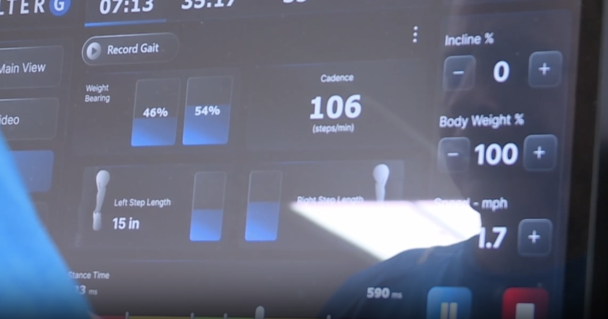 FutureCare's comprehensive rehab gets patients back on their feet