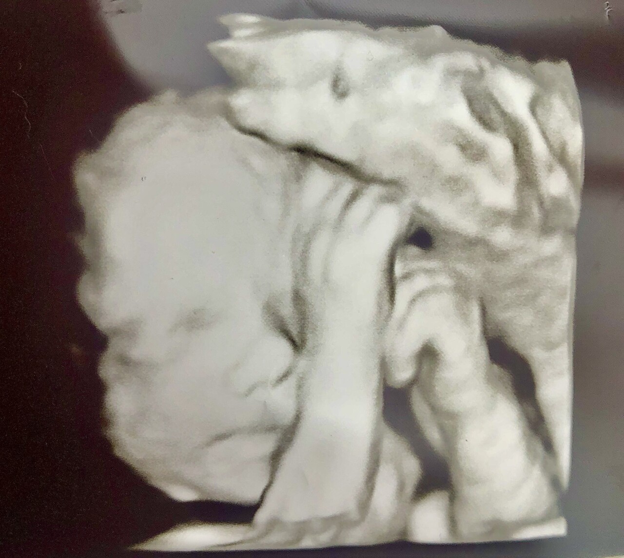 Brie pregnancy 3D