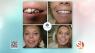 Why quality matters when it comes to dental implants at Gasser Dental Implants