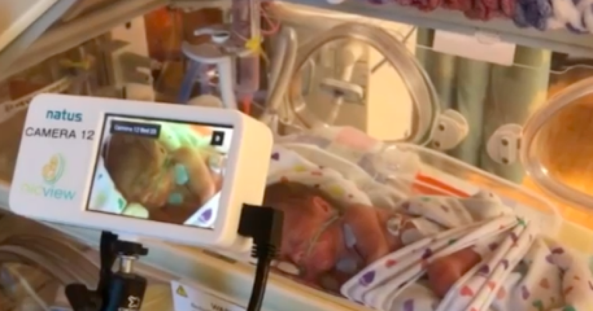 Chippenham Hospital's NICU closing, consolidating with JohnstonWillis