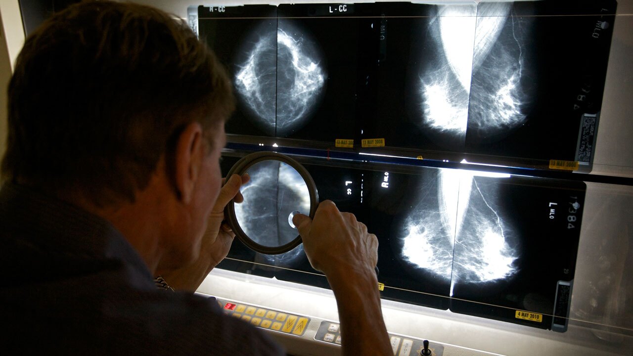 Radiologist checks mammograms