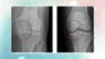 What is Regenerative Medicine?