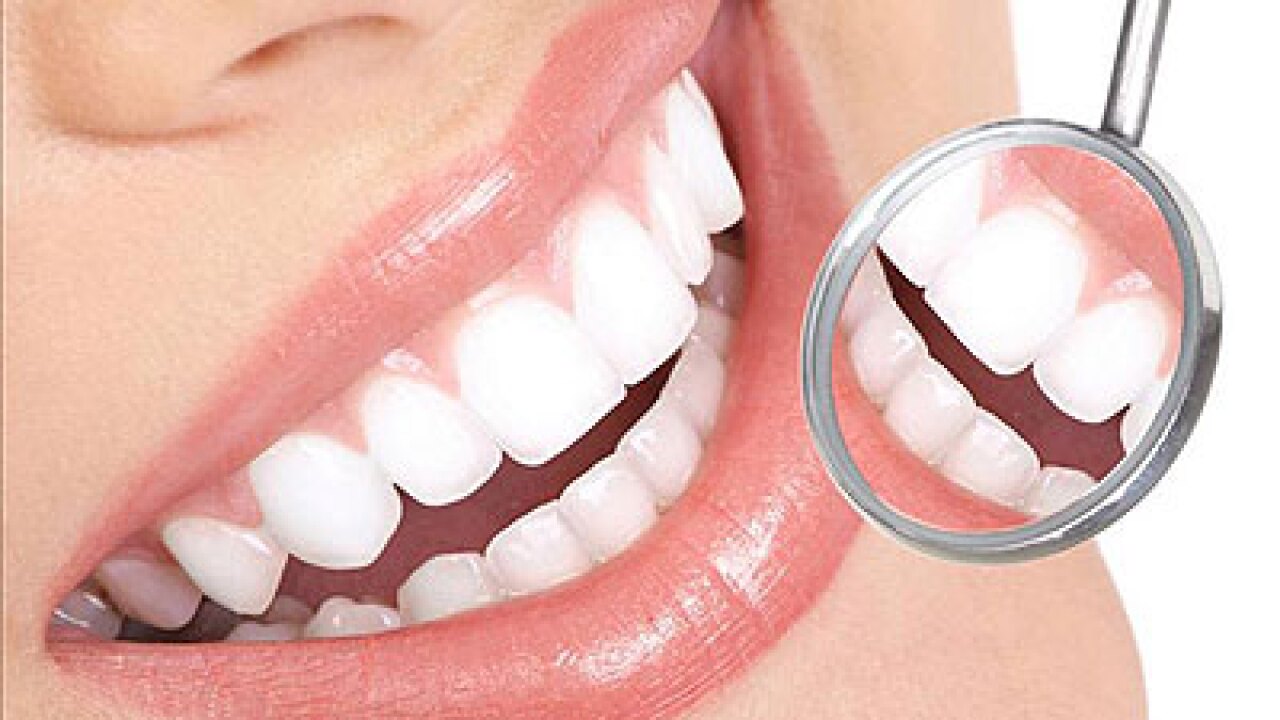 Est-ce que ça vaut le coup? News 3 teste un kit de blanchiment des dents à domicile de 20 minutes