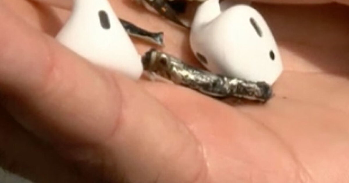 Exploding Airbuds Apple Florida man says Apple AirPods caught fire while working out