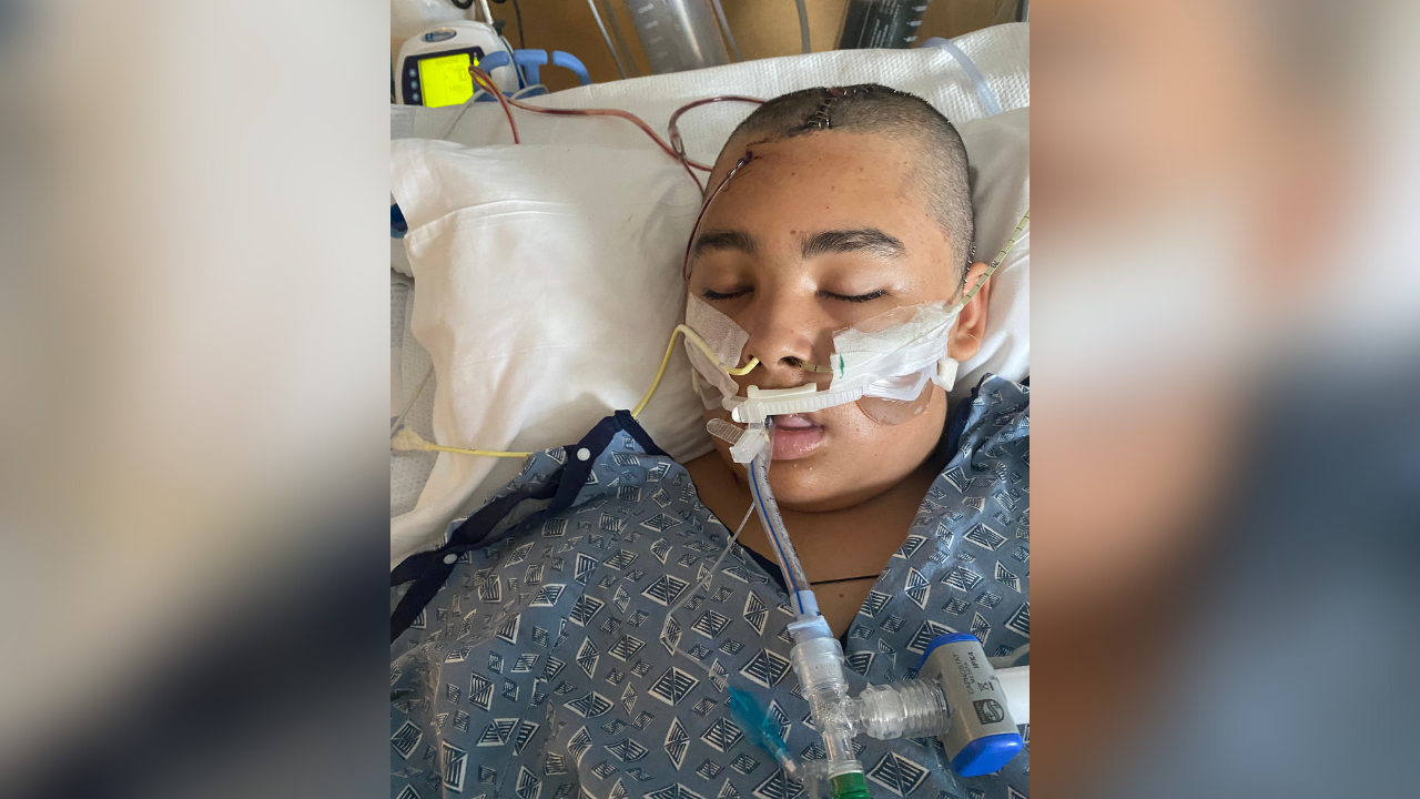 Tampa Bay Area teen makes miraculous recovery after being hit by boat's propeller