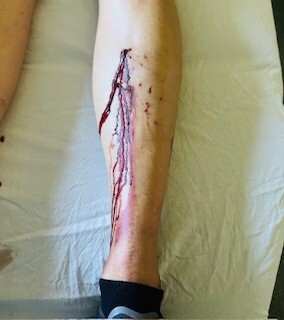 Tulsa tough dog bite.jpg