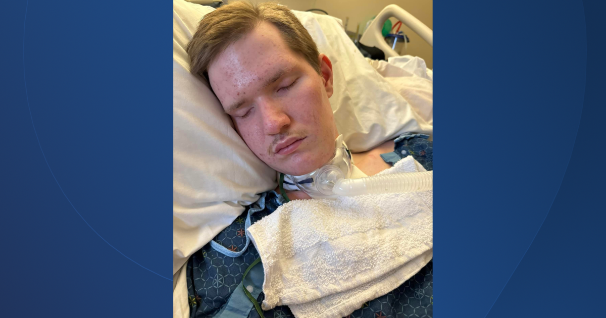NKY family sues 2 restaurants for serving alcohol to underaged son before injury - Vimarsana News