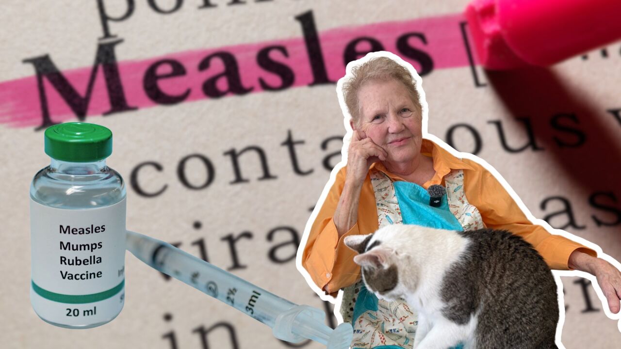 measles Sheboygan County